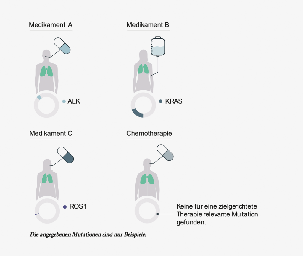 Behandlungsmöglichkeiten bei Krebs